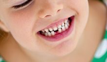 Çocuklarda Süt Dişlerinin Önemi