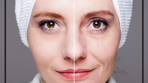 Fransız Askı Kimler için Uygundur