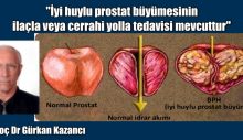 İyi huylu prostat büyümesinin ilaçla veya cerrahi yolla tedavisi mevcuttur