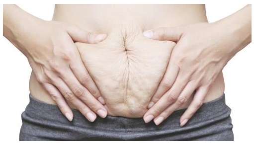 DOĞUM SONRASI ESKİ VÜCUDA KAVUŞMAK HAYAL DEĞİL