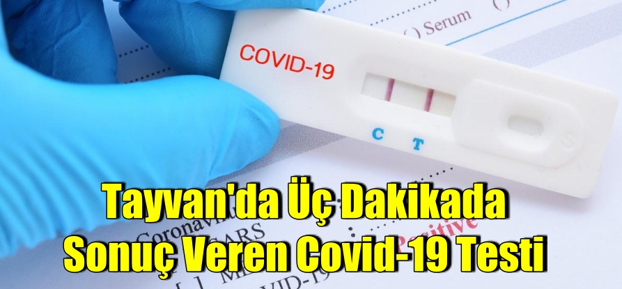 Tayvan’da üç dakikada sonuç veren Covid-19 testi geliştirildi