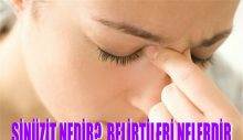 SİNÜZİT NEDİR ? BELİRTİLERİ NELERDİR