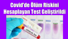 Covid’de ölüm riskini hesaplayan test geliştirildi