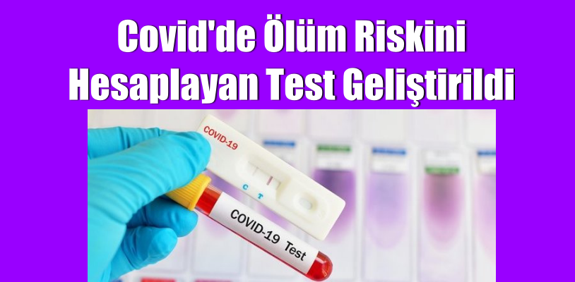 Covid’de ölüm riskini hesaplayan test geliştirildi