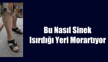 Bu Nasıl Sinek- Isırdığı yeri morartıyor