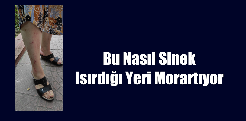Bu Nasıl Sinek- Isırdığı yeri morartıyor