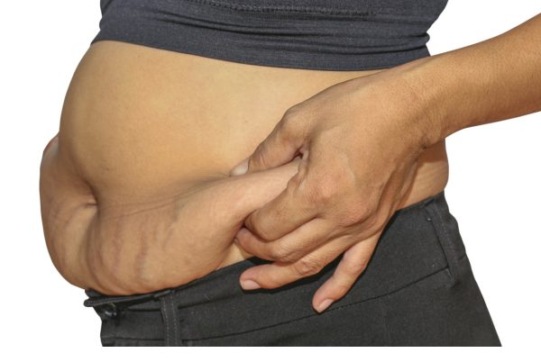 OBEZİTE PSİKOLOJİYİ OLUMSUZ ETKİLİYOR !